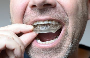 A man putting a dental mouth guard on his teeth.