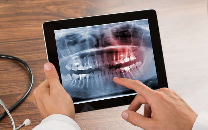 Dentist revising dental x-rays on a tablet.