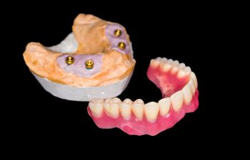 A model of a denture on a black background.