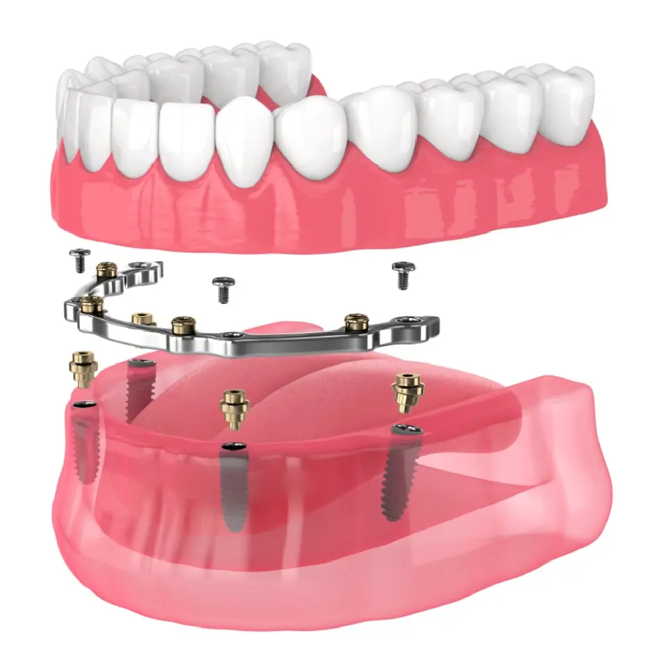 image sh 2138224167.jpg