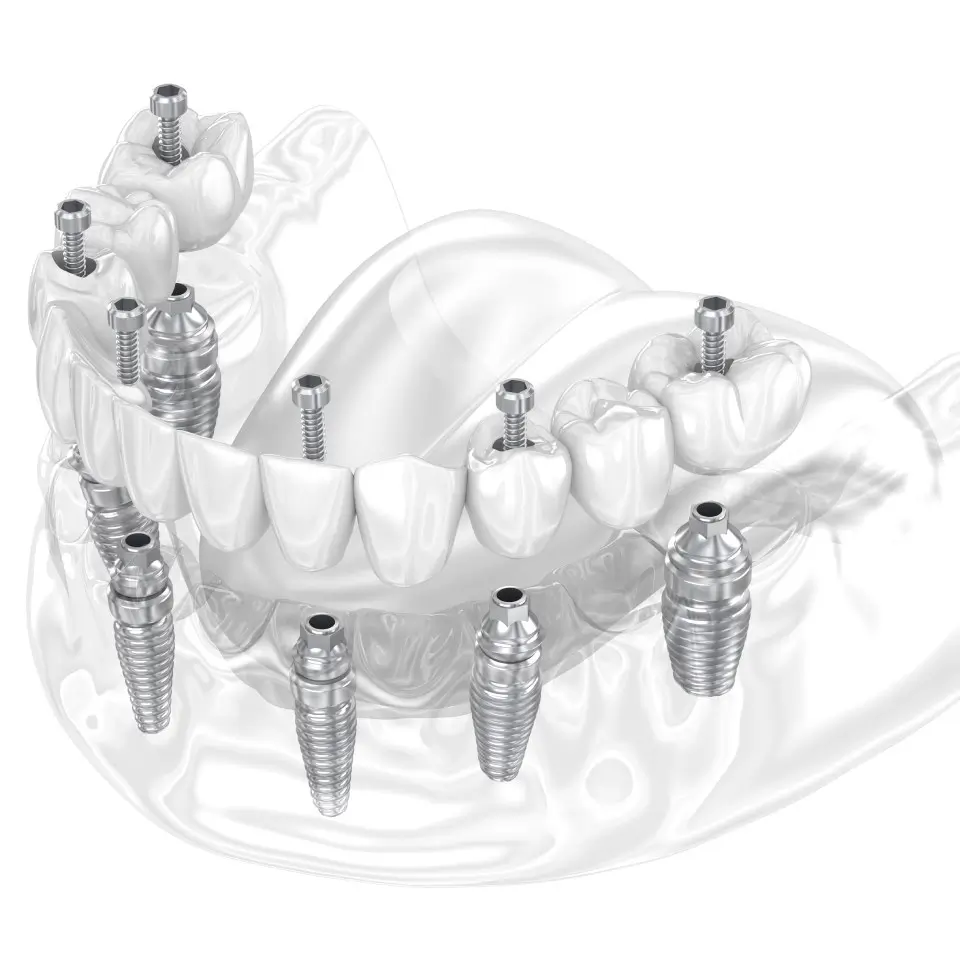 image sh 2234261297.jpg