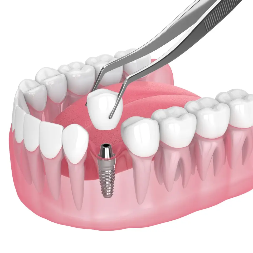 image sh 2349007191.jpg